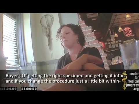 Intact Fetuses &quot;Just a Matter of Line Items&quot; for Planned Parenthood TX Mega-Center