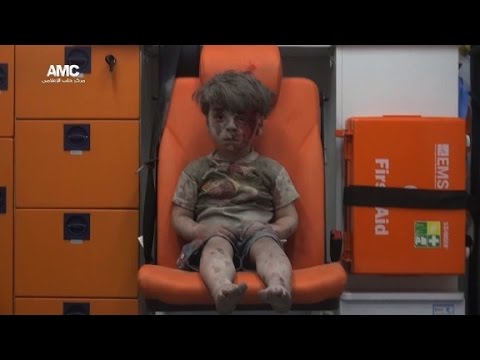 Little boy in Aleppo a vivid reminder of war&#039;s horror