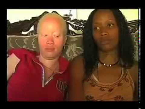 Oscar winner Lupita Nyong&#039;o &quot;In My Genes&quot; Documentary on Albinism Trailer